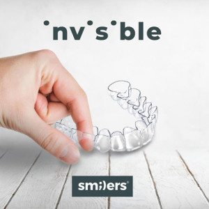 SCM Bellecour - orthodontie invisible avec les aligneurs smilers