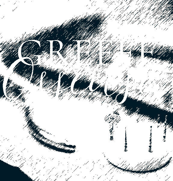 La 𝗴𝗿𝗲𝗳𝗳𝗲 𝗼𝘀𝘀𝗲𝘂𝘀𝗲 pratiquée à la SCM Bellecour est une procédure qui permet de reconstruire ou de renforcer l’os de la mâchoire pour soutenir les implants dentaires.