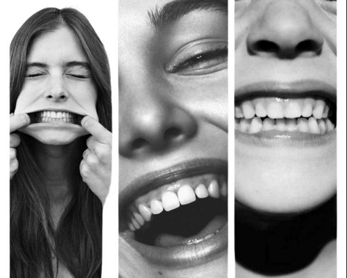 SCM Bellecour - L'implant dentaire : Comment ca fonctionne ?