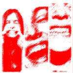 SCM Bellecour - les implants dentaires