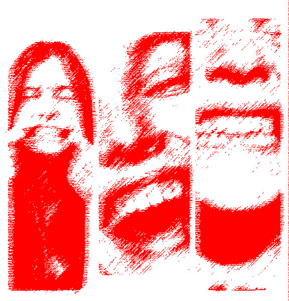 SCM Bellecour - les implants dentaires