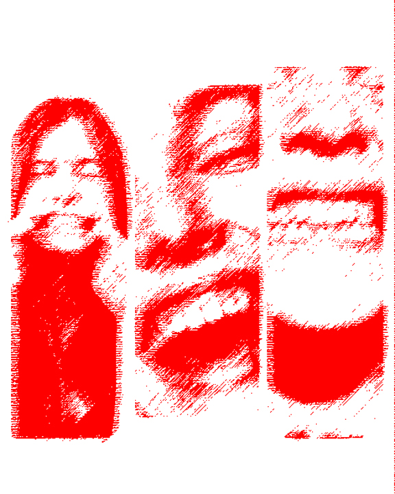 SCM Bellecour - les implants dentaires