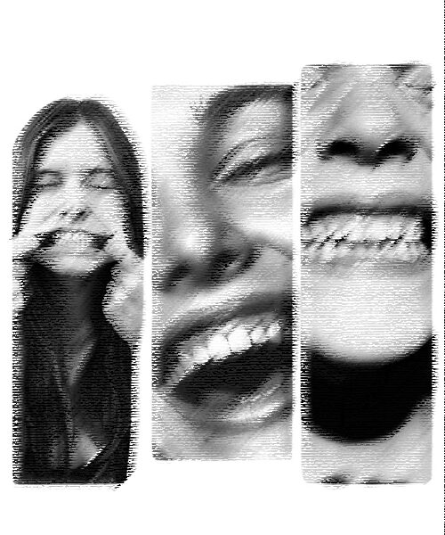 SCM Bellecour - les implants dentaire