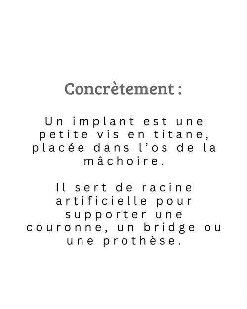 SCM Bellecour - L'implant dentaire : Concretements ?