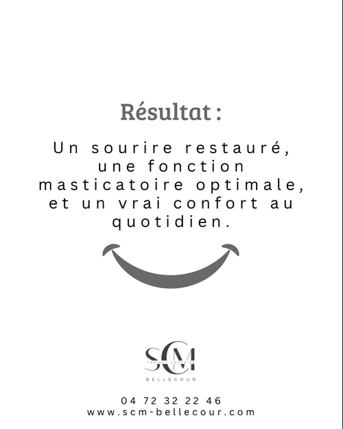 SCM Bellecour - L'implant dentaire : Résultats