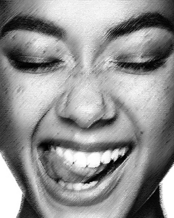 SCM Bellecour - brossage de la langue