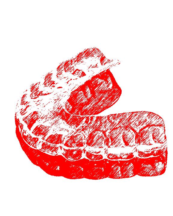 SCM Bellecour - l'orthodontie invisible