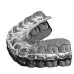 SCM Bellecour - L'Orthodontie ?