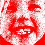 SCM Bellecour - traitement des dents de lait