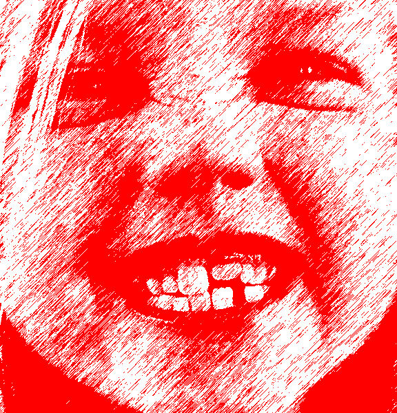 SCM Bellecour - traitement des dents de lait