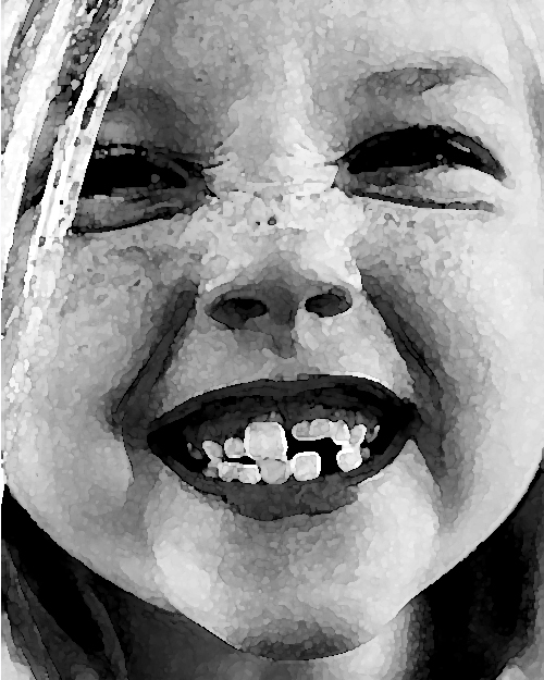 SCM Bellecour - les dents de lait