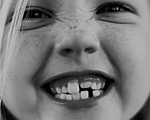 SCM Bellecour - les dents de lait
