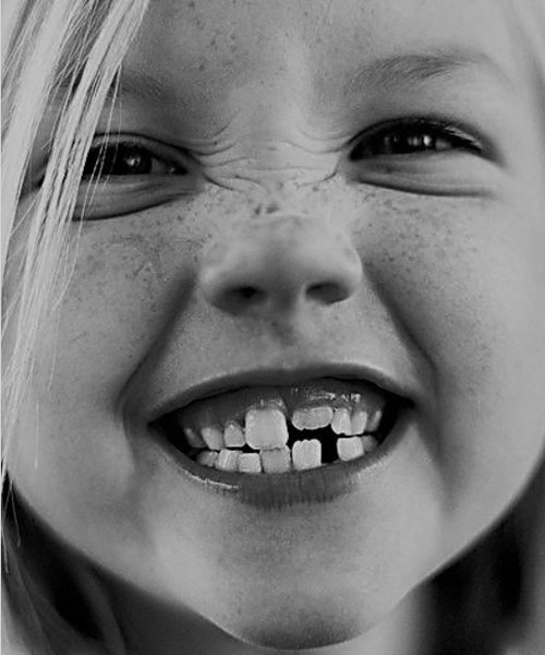 SCM Bellecour - les dents de lait