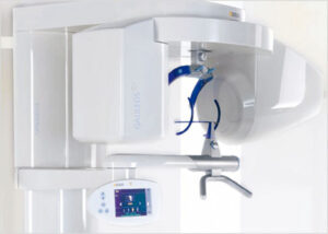 SCM Bellecour : Equipement 3D